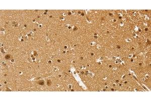 Immunohistochemistry of paraffin-embedded Human brain using PSMC1 Polyclonal Antibody at dilution of 1:40 (PSMC1 antibody)