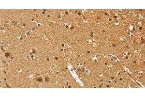 Immunohistochemistry of paraffin-embedded Human brain using PSMC1 Polyclonal Antibody at dilution of 1:40