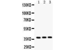 Anti- IL3 antibody, Western blotting All lanes: Anti IL3  at 0. (IL-3 antibody  (AA 28-166))