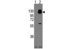 Image no. 1 for anti-Cadherin 13 (CDH13) (N-Term) antibody (ABIN356920) (Cadherin 13 antibody  (N-Term))