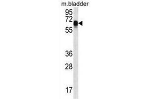 CCDC102A Antibody (C-term) western blot analysis in mouse bladder tissue lysates (35µg/lane). (CCDC102A antibody  (C-Term))