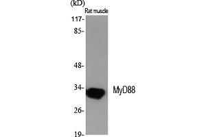 Western Blot analysis of various cells using MyD88 Polyclonal Antibody diluted at 1:2000.