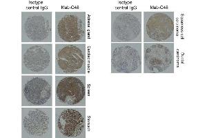 Immunohistochemistry Mab-C48 or control IgG (1 g /mL) was applied to human normal organ tissue array and tumor tissue array.