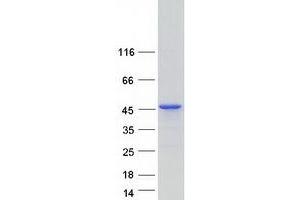 MAGI Family Member, X-Linked (MAGIX) (Transcript Variant 1) protein (Myc-DYKDDDDK Tag)