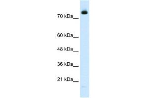 WB Suggested Anti-ZMYM3 Antibody Titration:  2.