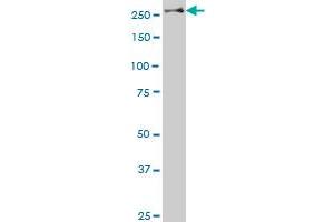 STAB1 polyclonal antibody (A01), Lot # 060707JCS1 Western Blot analysis of STAB1 expression in SJCRH30 . (Stabilin 1 antibody  (AA 1804-1902))