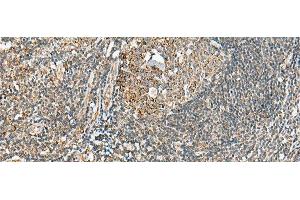 Immunohistochemistry of paraffin-embedded Human tonsil tissue using MOB2 Polyclonal Antibody at dilution of 1:40(x200) (MOB2 antibody)
