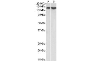 ABIN5539667 (0. (REST antibody  (Internal Region))