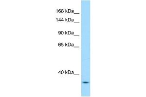 WB Suggested Anti-Yeats2 Antibody Titration: 1. (YEATS2 antibody  (N-Term))