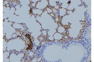 ABIN6275023 at 1/100 staining Mouse lung tissue by IHC-P.