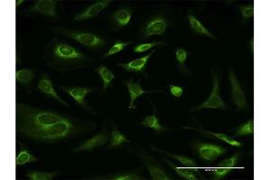 Immunofluorescence of monoclonal antibody to RPN1 on HeLa cell. (RPN1 antibody  (AA 24-607))