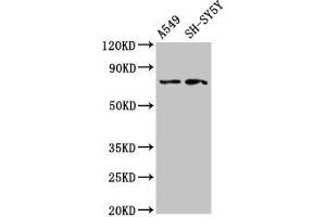 Western Blot Positive WB detected in: A549 whole cell lysate, SH-SY5Y whole cell lysate All lanes: MASP2 antibody at 2.