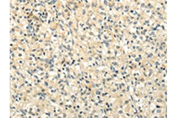 BRWD1 antibody