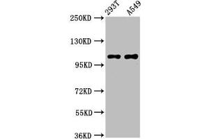 Western Blot Positive WB detected in: 293T whole cell lysate, A549 whole cell lysate All lanes: ICE2 antibody at 4. (NARG2 antibody  (AA 876-982))