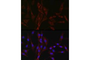 Immunofluorescence analysis of NIH/3T3 cells using CH Rabbit pAb (ABIN7266015) at dilution of 1:100 (40x lens). (CACNA1H antibody  (AA 260-360))