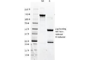 SDS-PAGE Analysis Purified CD90 Mouse Monoclonal antibody (F15-42-1). (CD90 antibody)