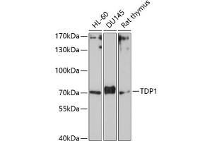Western blot analysis of extracts of various cell lines, using TDP1 Antibody (ABIN1682992, ABIN3019238, ABIN3019239 and ABIN6220782) at 1:1000 dilution. (TDP1 antibody  (AA 1-140))