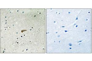 Immunohistochemical analysis of paraffin-embedded human brain tissue using FRS2 (Phospho-Tyr436) antibody (left)or the same antibody preincubated with blocking peptide (right). (FRS2 antibody  (pTyr436))