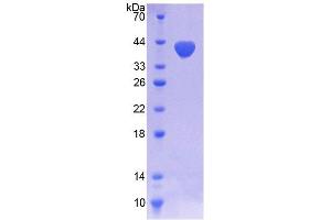 SDS-PAGE (SDS) image for NADPH Oxidase 5 (NOX5) (AA 456-765) protein (His tag) (ABIN4988462) (NOX5 Protein (AA 456-765) (His tag))