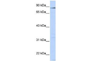 WB Suggested Anti-L3MBTL4 Antibody Titration:  0. (L3MBTL4 antibody  (N-Term))