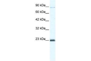 WB Suggested Anti-MCM4 Antibody Titration:  5. (MCM4 antibody  (C-Term))
