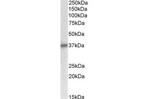 AP32139PU-N Delta-Sarcoglycan antibody staining of Human Heart lysate at 0. (SGCD antibody  (Internal Region))