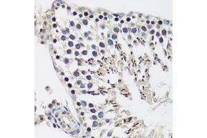 Immunohistochemistry of paraffin-embedded rat testis using C antibody (ABIN6127552, ABIN6137952, ABIN6137953 and ABIN6216977) at dilution of 1:100 (40x lens). (CASC5 antibody  (AA 1-300))
