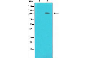 Western blot analysis on HeLa cell lysate using HDAC7 Antibody,The lane on the left is treated with the antigen-specific peptide. (HDAC7 antibody  (Internal Region))