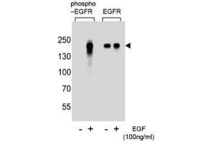 Western blot analysis of extracts from A431 cells, untreated or treated with EGF, using phospho-EGFR antibody (left) or nonphos Ab (right) (EGFR antibody  (pTyr1172))