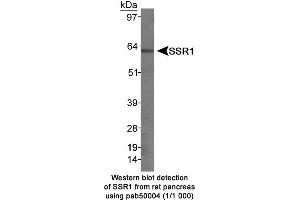 Image no. 1 for anti-Somatostatin Receptor 1 (SSTR1) (C-Term) antibody (ABIN363313) (SSTR1 antibody  (C-Term))