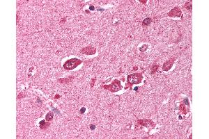 Anti-TRIM38 antibody IHC of human brain, cortex. (TRIM38 antibody  (C-Term))