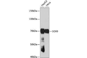 Western blot analysis of extracts of various cell lines, using SOX9 antibody (ABIN7270577) at 1:1000 dilution.