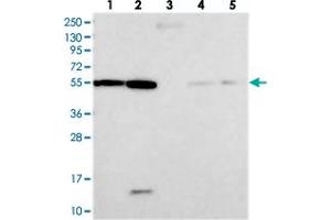 Western blot analysis of Lane 1: RT-4, Lane 2: U-251 MG, Lane 3: Human Plasma, Lane 4: Liver, Lane 5: Tonsil with DEPDC4 polyclonal antibody  at 1:250-1:500 dilution.