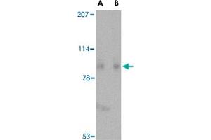 Western blot analysis of SLITRK1 in human brain tissue lysate with SLITRK1 polyclonal antibody  at (A) 1 and (B) 2 ug/mL . (SLITRK1 antibody  (C-Term))