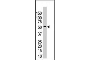 The USP14 polyclonal antibody  is used in Western blot to detect USP14 in HeLa cell lysates . (USP14 antibody  (N-Term))