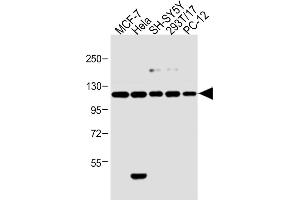 All lanes : Anti-Insulin Receptor R Antibody (N-term) at 1:2000 dilution Lane 1: 293T/17 whole cell lysate Lane 2: Hela whole cell lysate Lane 3: MCF-7 whole cell lysate Lane 4: PC-12 whole cell lysate Lane 5: SH-SY5Y whole cell lysate Lysates/proteins at 20 μg per lane. (Insulin Receptor antibody  (N-Term))