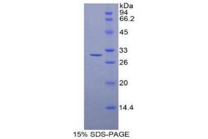 SDS-PAGE (SDS) image for Histone Deacetylase 6 (HDAC6) (AA 565-813) protein (His tag) (ABIN1878886) (HDAC6 Protein (AA 565-813) (His tag))