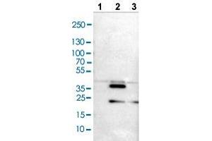 Western blot analysis of Lane 1: NIH/3T3 cell lysate, Lane 2: NBT-II cell lysate, and Lane 3: PC-12 cell lysate with CRKL polyclonal antibody . (CrkL antibody  (AA 125-301))