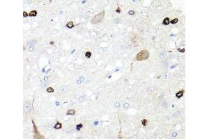 Immunohistochemistry of paraffin-embedded Rat brain using IGFBP5 Polyclonal Antibody at dilution of 1:100 (40x lens).