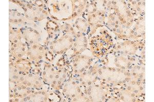 Immunohistochemistry (IHC) image for anti-Nuclear Factor-kB p65 (NFkBP65) (pSer536) antibody (ABIN6255402)