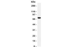 Westrn blot testing of HIF-3 alpha antibody and rat brain tissue lysate. (HIF3A antibody  (C-Term))