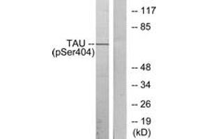 Western blot analysis of extracts from 293 cells treated with UV, using Tau (Phospho-Ser404) Antibody.