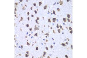 Immunohistochemistry (Paraffin-embedded Sections) (IHC (p)) image for anti-UPF1 Regulator of Nonsense Transcripts Homolog (UPF1) (AA 270-370) antibody (ABIN6149938)