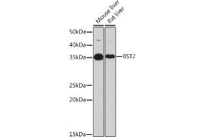 Western blot analysis of extracts of various cell lines, using BST2 Rabbit mAb (ABIN7265893) at 1:1000 dilution. (BST2 antibody)
