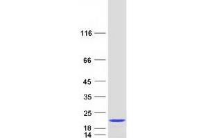 Western Blotting (WB) image for Protein Phosphatase 1, Regulatory Subunit 27 (PPP1R27) protein (Myc-DYKDDDDK Tag) (ABIN2719888)