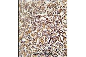 Immunohistochemistry (Paraffin-embedded Sections) (IHC (p)) image for anti-Negative Regulator of Reactive Oxygen Species (NRROS) (AA 611-640), (C-Term) antibody (ABIN654275)