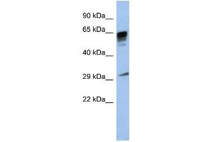 WB Suggested Anti-PRR18 Antibody Titration: 0. (Proline Rich 18 antibody  (Middle Region))