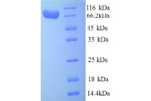 SDS-PAGE (SDS) image for Iduronidase, alpha-L- (IDUA) (AA 28-653) protein (His tag) (ABIN4976137)