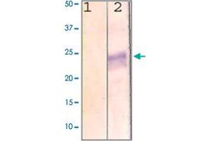 The cell lysate derived from MCF-7 was immunoprobed by RHO polyclonal antibody  at 1 : 500. (Rho-related GTP-binding protein antibody  (C-Term))