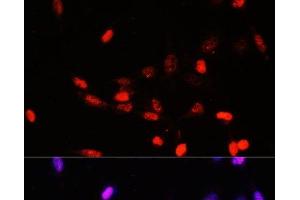 Immunofluorescence analysis of NIH/3T3 cells using COPS5 Polyclonal Antibody at dilution of 1:100. (COPS5 antibody)